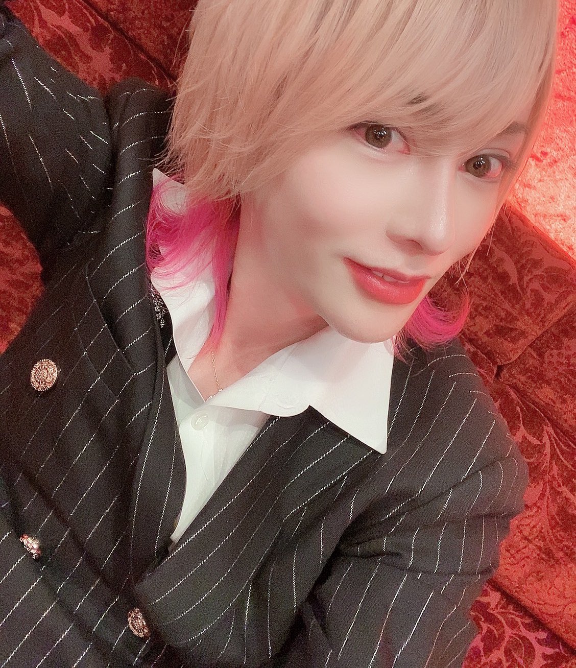 プリンスこうやが整形した理由は何？